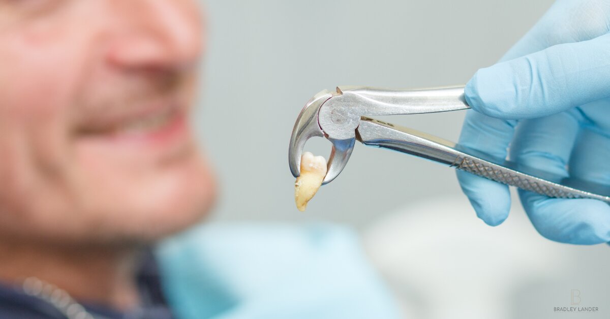 Aftercare Tooth Extraction