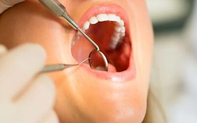 7 Warning Signs of Gum Disease You Should Never Ignore