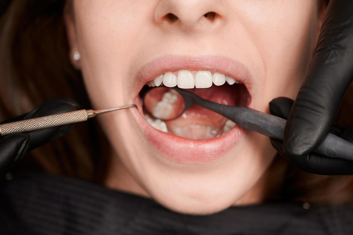 dental bone grafting img