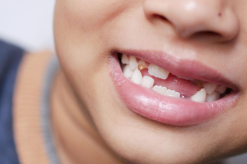 teeth img