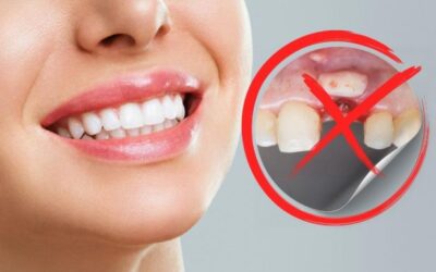 Receding Gums: When Is Gum Grafting the Best Treatment?