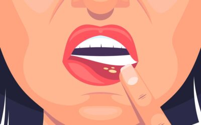 Periodontist vs Oral Surgeon: Who Should You See for Dental Implants?