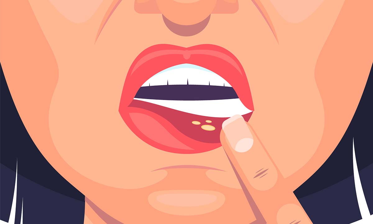 image Periodontal Problems image Periodontal Problems