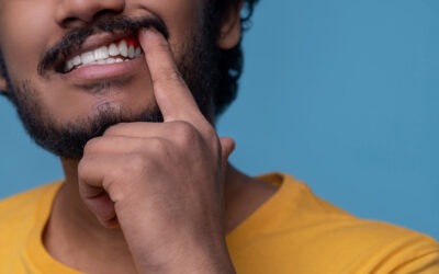 Missing a Front Tooth? Why Dental Implant Planning Is Different in the Smile Zone